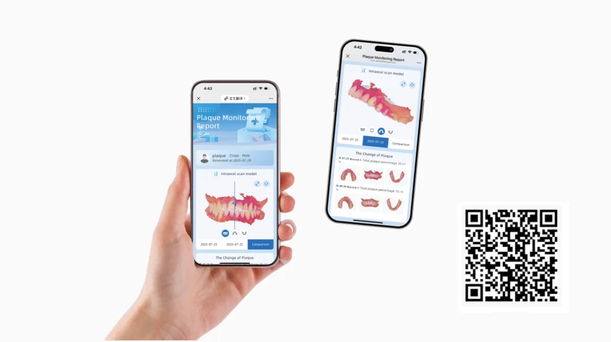 Aoralscan Elf tarama verileriyle oluşturulmuş dijital raporları gösteren telefon ekranları